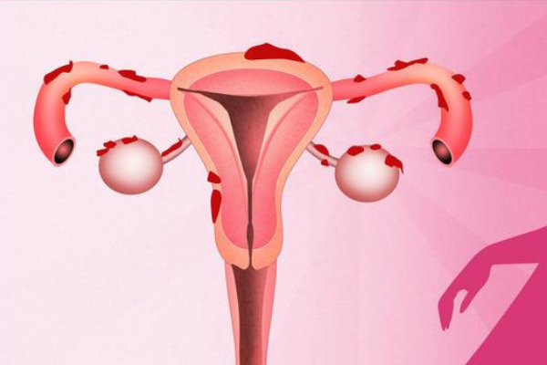 子宫偏小能不能怀孕很难说，主要还得由激素决定