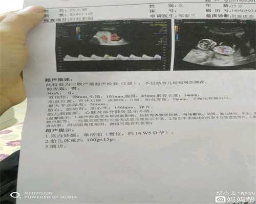 重庆代生宝宝咨询_意外怀孕一个月可以流产吗