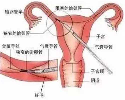 重庆急找代孕`重庆试管哪里最好`租重庆女人生孩子多少钱啊
