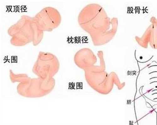 重庆找人代生小孩需要什么条件：供卵代生孩子零风险包成功_供卵代生双胞胎