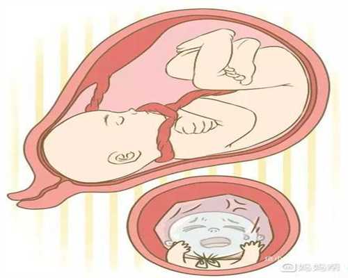 重庆代孕需多少钱：妊娠牙龈炎对胎儿的影响