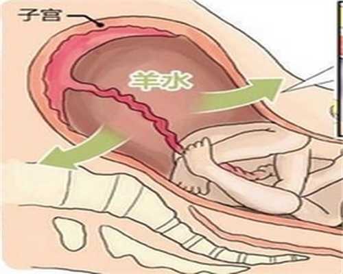 重庆找个代孕的：什么原因会引起孕妇肚子疼呢？