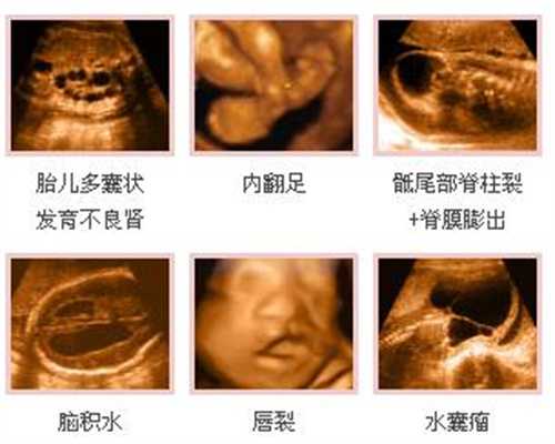 重庆专业代孕网站：怀头胎和怀二胎反应有差别吗