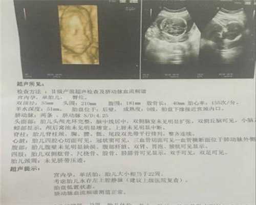 重庆怎么找代孕网：产后检查有哪些项目？你的身体复原了吗？