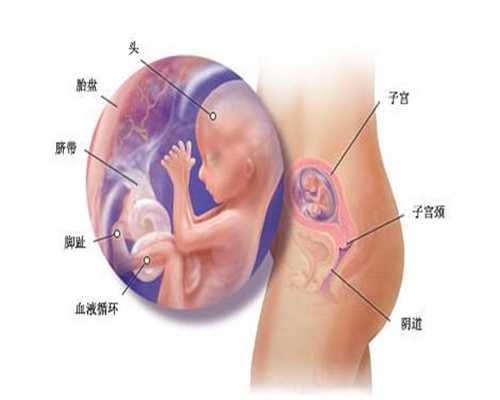 重庆怎么找代孕网：产后检查有哪些项目？你的身体复原了吗？