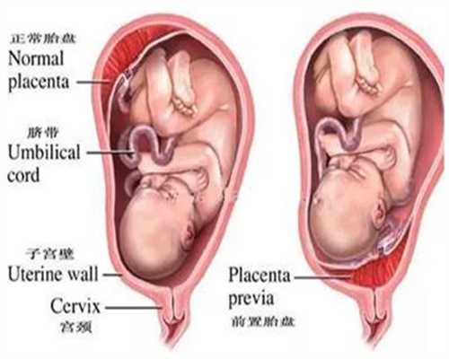 重庆代孕前期检查：叶酸吃到什么时候停止