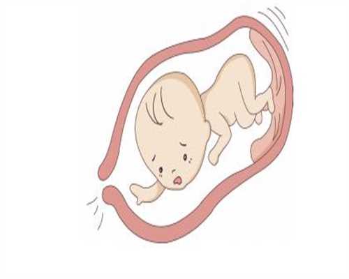 重庆代孕中介名称：怀孕八个月痔疮流血会影响胎儿吗