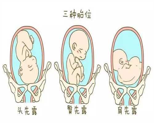 重庆正规的代孕：无痛人流后要注意哪些