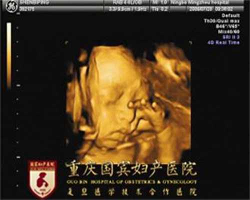重庆最便宜的代孕公司：怀孕五个月做什么运动