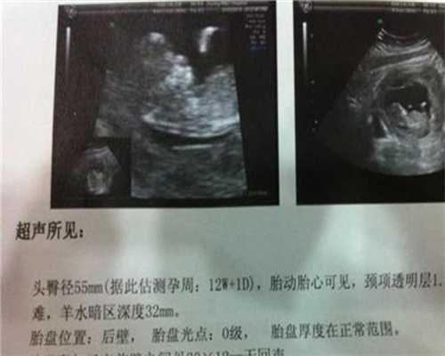 重庆正规代孕费用：两个月的孕酮值是多少