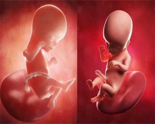 重庆代孕产子到哪里找：胎儿四肢偏短会不会影响智力