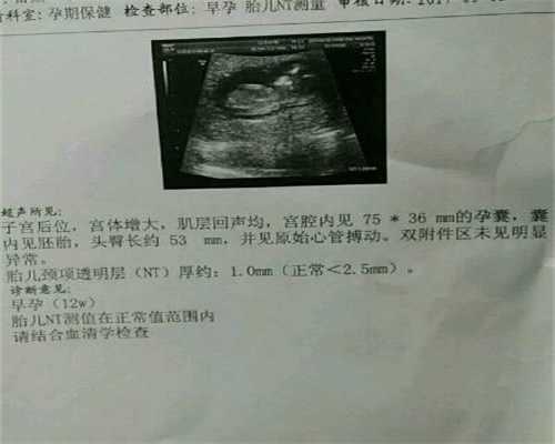 重庆正定代孕网：专业代怀孕哪里有_代怀孕是什么意思