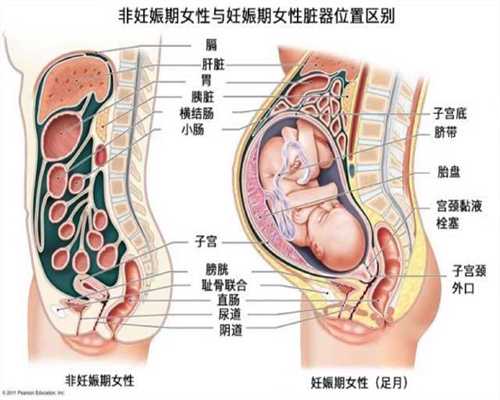重庆代生宝宝医生咨询：供卵代生小孩机构_代生孩子协议书